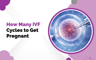 How Many IVF Cycles to Get Pregnant