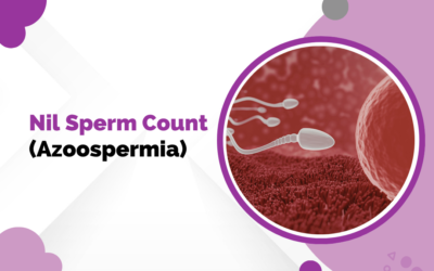 Nil Sperm Count (Azoospermia)