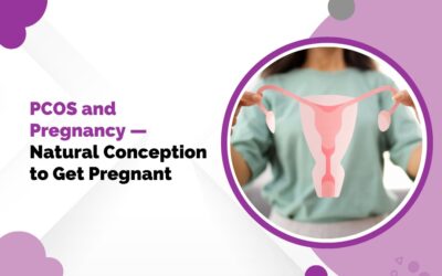 PCOS and Natural Pregnancy