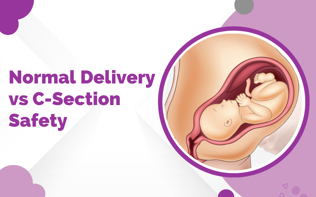Normal Delivery vs C-Section Safety