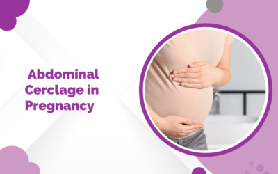 Abdominal Cerclage in Pregnancy: What It Is, Who Needs It, and What to Expect