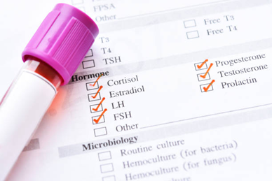 Picture3 | drmanishamehta.com Medical lab form with checkmarks for cortisol, estradiol, LH, FSH, and prolactin; pink-topped sample vial nearby.