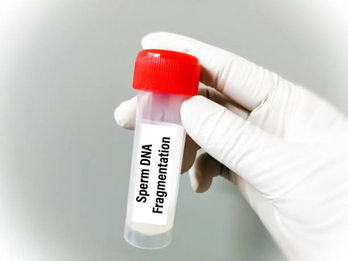 Picture6 | drmanishamehta.com Gloved hand holding a small specimen tube labeled 'Sperm DNA Fragmentation' with a red cap.