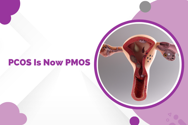 Graphic banner with the text 'PCOS Is Now PMOS' next to a circular illustration of female reproductive organs framed in purple.