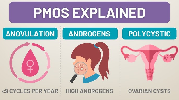 PMOS explained: Anovulation panel showing circular arrows around a pink drop with a female symbol and the caption '