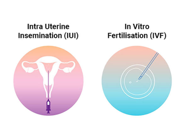 Two fertility-treatment icons: left shows a uterus diagram for intrauterine insemination (IUI); right shows a pipette over a Petri dish for in vitro fertilisation (IVF).